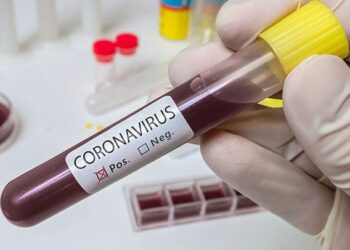 GHS Records 131 New Covid-19 Cases