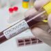 GHS Records 131 New Covid-19 Cases
